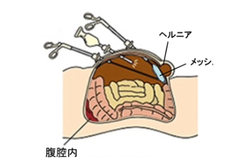 治療方法